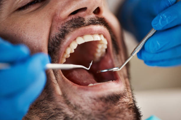 Best Emergency Denture Repair in Pocola, OK